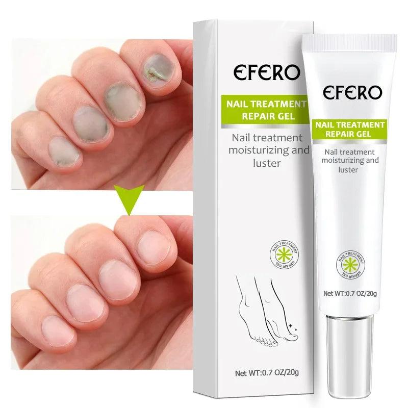 "Efero | Crema Antiinflamatoria para Eliminar Hongos - Tú Plena